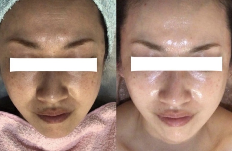 日向市おすすめのフェイシャルkok＆co.